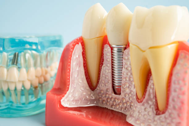 Reliable Bonham, TX  Dental Services Solutions